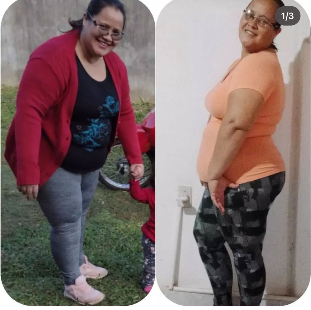 paciente Claudia 