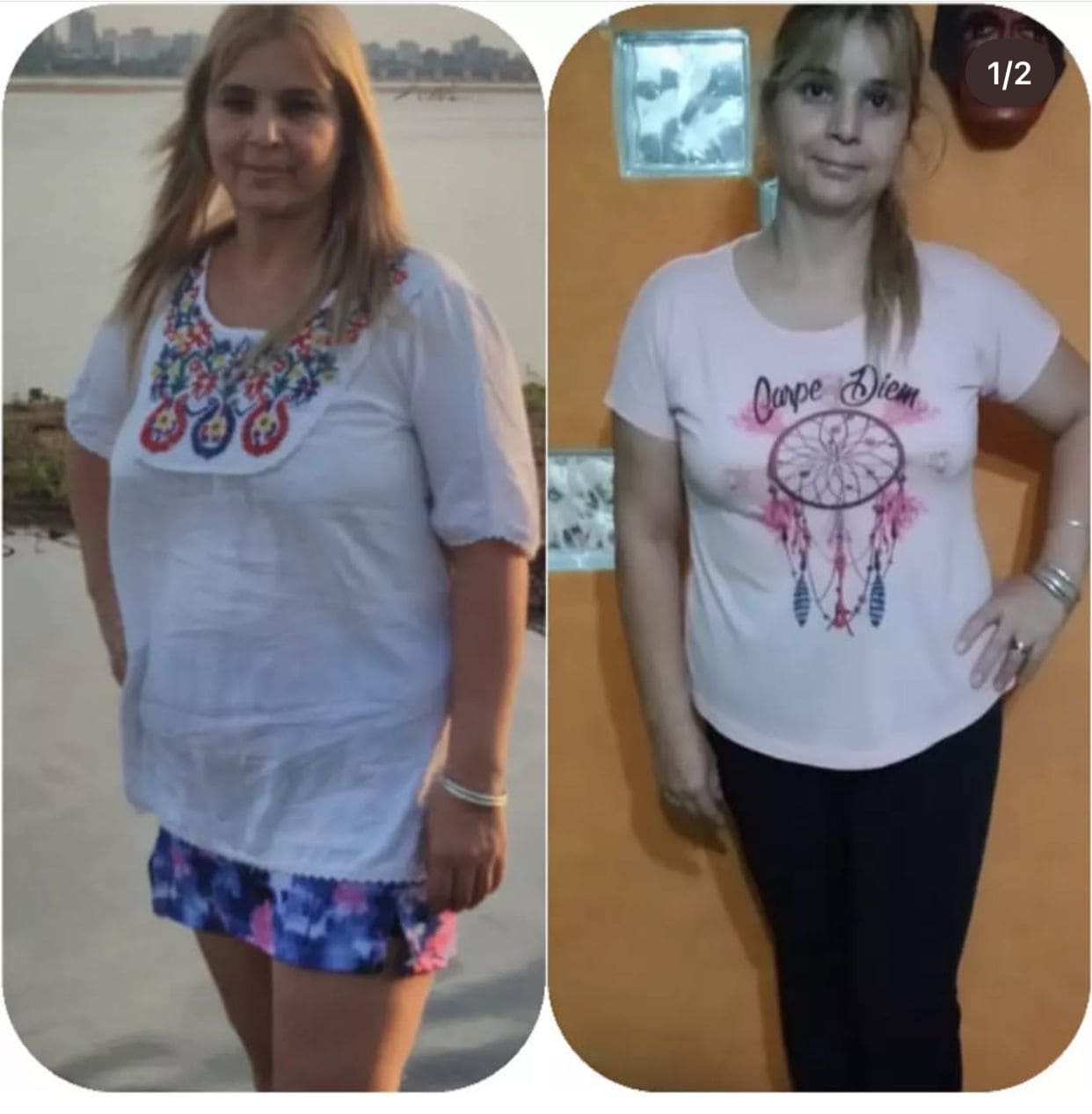 paciente Karina