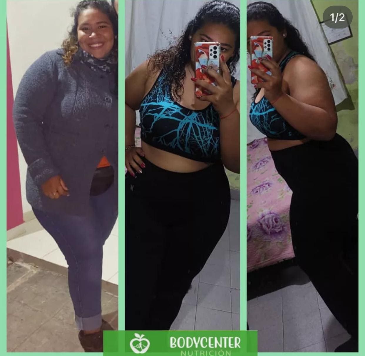 paciente Yuli
